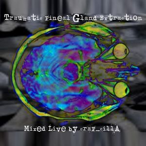 Traumatic Pineal Gland Extraction _live mix